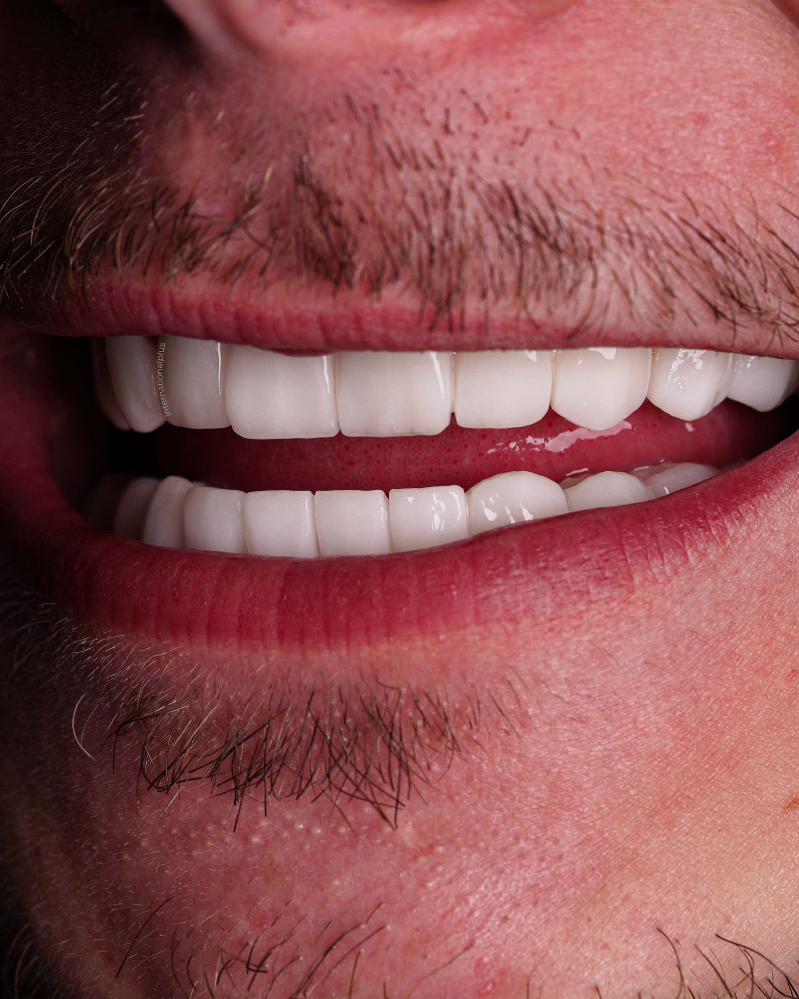 WhatsApp Image 2025-03-25 at 10.38.23 AM (1)