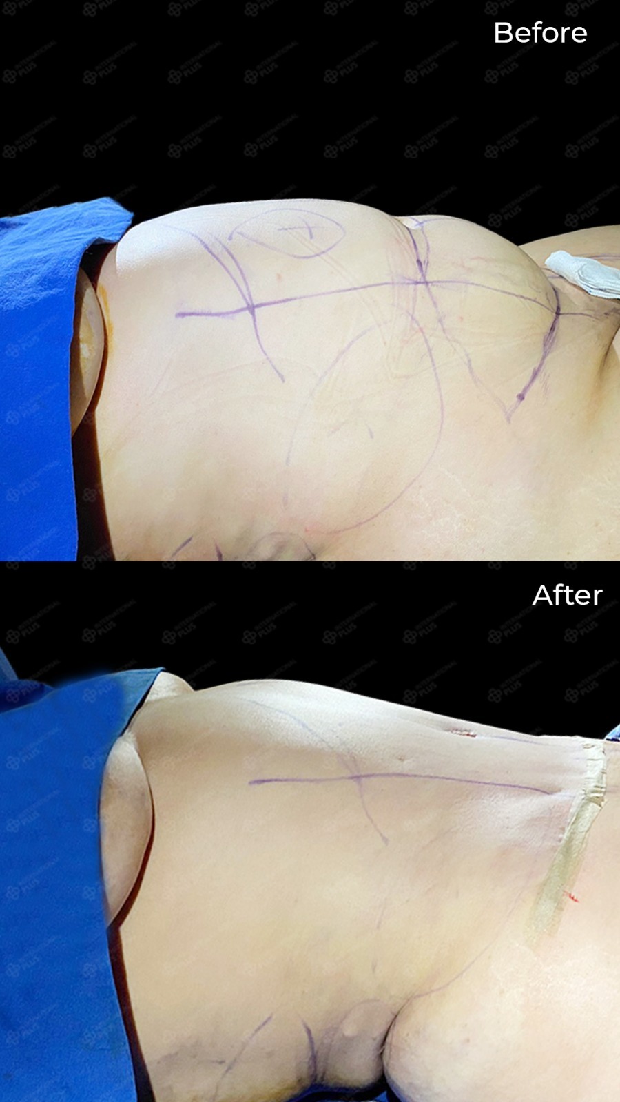 WhatsApp Image 2025-04-08 at 3.46.05 PM (2)