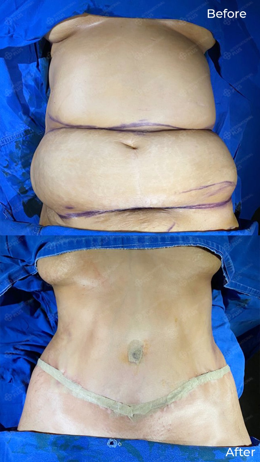 WhatsApp Image 2025-04-08 at 3.46.05 PM (3)