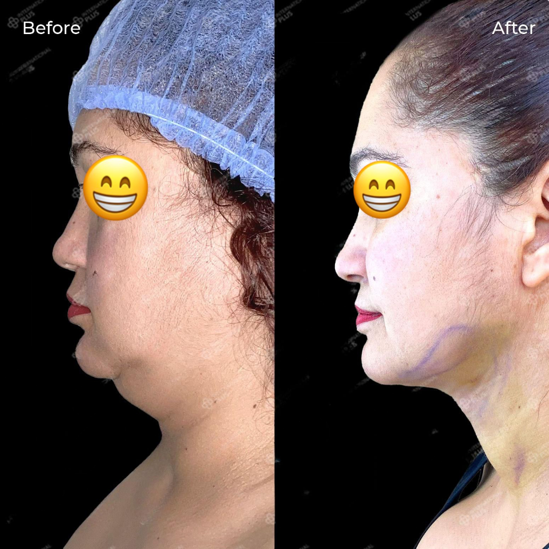 WhatsApp Image 2025-04-09 at 3.47.04 PM (3)