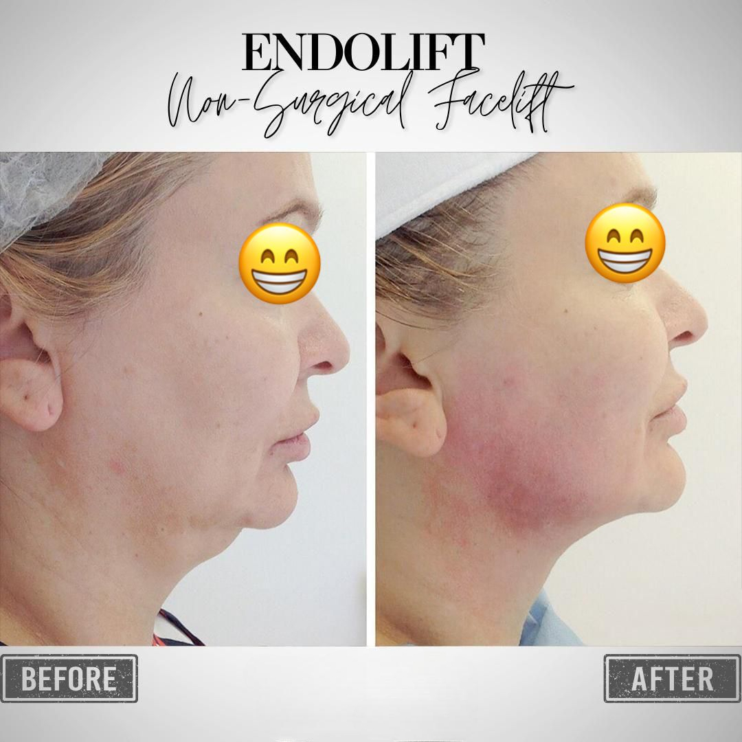 WhatsApp Image 2025-04-09 at 3.47.05 PM