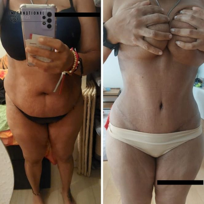 WhatsApp Image 2025-04-09 at 6.44.40 PM